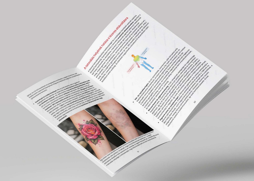 LÉZERES KOZMETIKAI KEZELÉSI ALAPISMERETEK ÉS KIEMELT KEZELÉSI TECHNIKÁK KÖNYV