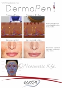 DermaPen - MezoPen kozmetikai készülék - DP03 - ELKON ELKONcosmetic Kft.